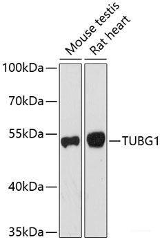 Western blot analysis of extracts of THP-1 cells using SPN Polyclonal Antibody at dilution of 1:1000.
