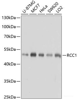 Immunofluorescence analysis of A549 cells using DDIT3 / CHOP Polyclonal Antibody