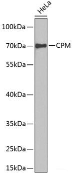 Western blot analysis of extracts of various cell lines using RPS14 Polyclonal Antibody at dilution of 1:1000.