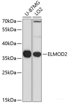 Immunohistochemistry of paraffin-embedded Human stomach using MYLK Polyclonal Antibody at dilution of 1:100 (40x lens).