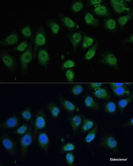 Western blot analysis of extracts of Mouse kidney using NOTCH4 Polyclonal Antibody at dilution of 1:1000.