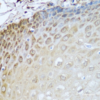 Immunohistochemistry of paraffin-embedded Rat lung using IL36G Polyclonal Antibody at dilution of 1:100 (40x lens).