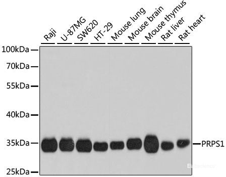 Immunohistochemistry of paraffin-embedded Mouse stomach using TAMM41 Polyclonal Antibody at dilution of 1:100 (40x lens).