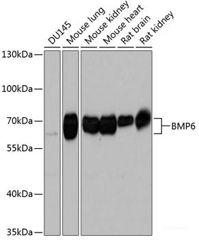 Western blot analysis of extracts of various cell lines using ZNF408 Polyclonal Antibody at dilution of 1:1000.