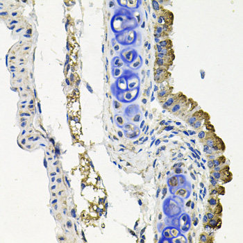 Confocal immunofluorescence analysis of U2OS cells using SEPT9 Polyclonal Antibody at dilution of 1:100. Blue: DAPI for nuclear staining.