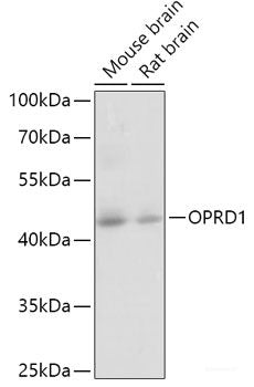 Western blot analysis of extracts of Rat kidney using SIX2 Polyclonal Antibody at dilution of 1:1000.