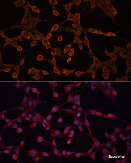 Immunohistochemistry of paraffin-embedded Rat heart using RPIA Polyclonal Antibody at dilution of 1:100 (40x lens).