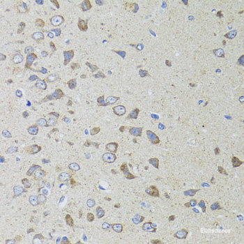 Immunofluorescence analysis of L929 cells using USP19 Polyclonal Antibody at dilution of 1:100. Blue: DAPI for nuclear staining.