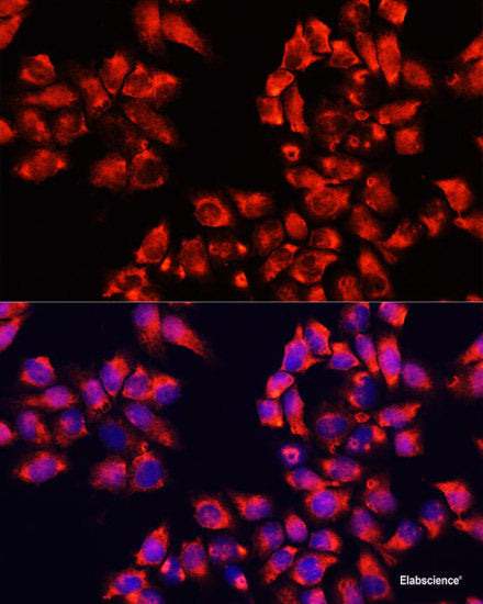 Immunohistochemistry of paraffin-embedded Mouse brain using CHRNB2 Polyclonal Antibody at dilution of 1:100 (40x lens).
