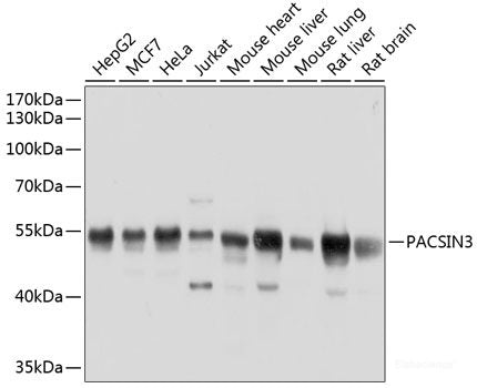 Western blot analysis of extracts of various cell lines using GRM5 Polyclonal Antibody at dilution of 1:1000.