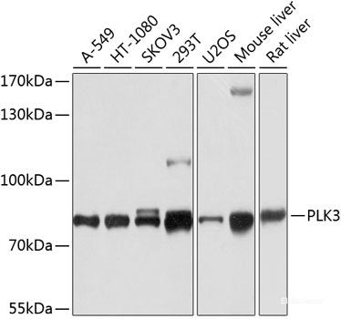 Immunohistochemistry of paraffin-embedded Human prostate using LCN1 Polyclonal Antibody at dilution of 1:100 (40x lens).