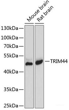 Immunohistochemistry of paraffin-embedded Rat kidney using MYO5A Polyclonal Antibody at dilution of 1:100 (40x lens).