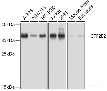 Western blot analysis of extracts of various cell lines using PPIC Polyclonal Antibody at dilution of 1:1000.