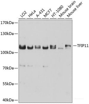Western blot analysis of extracts of various cell lines using CLEC7A Polyclonal Antibody at dilution of 1:1000.