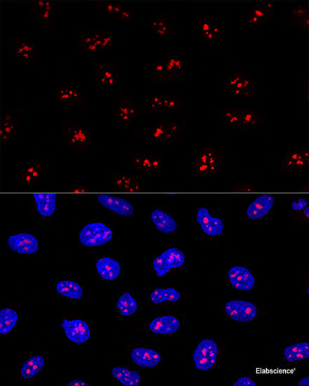 Western blot analysis of extracts of various cell lines using KCNJ6 Polyclonal Antibody at dilution of 1:1000.