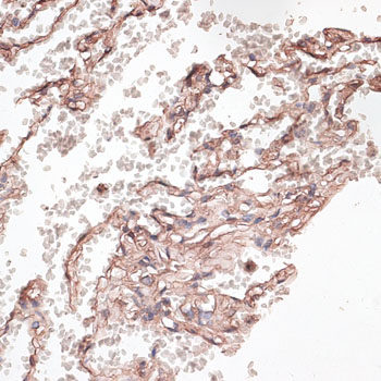 Immunohistochemistry of paraffin-embedded Mouse brain using BAF60a Polyclonal Antibody at dilution of 1:100 (40x lens).
