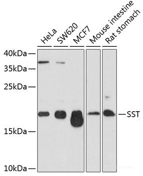 Immunohistochemistry of paraffin-embedded Human mammary cancer using SOCS6 Polyclonal Antibody at dilution of 1:100 (40x lens).