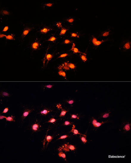 Immunohistochemistry of paraffin-embedded Human colon using TRIP12 Polyclonal Antibody at dilution of 1:100 (40x lens).
