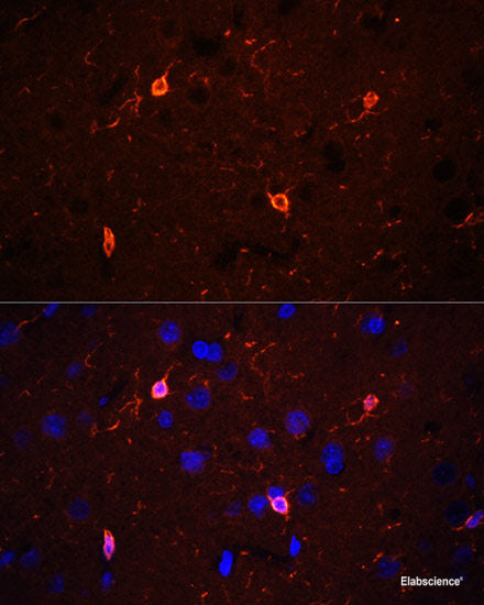 Western blot analysis of extracts of A-375 cells using CEP164 Polyclonal Antibody at dilution of 1:1000.