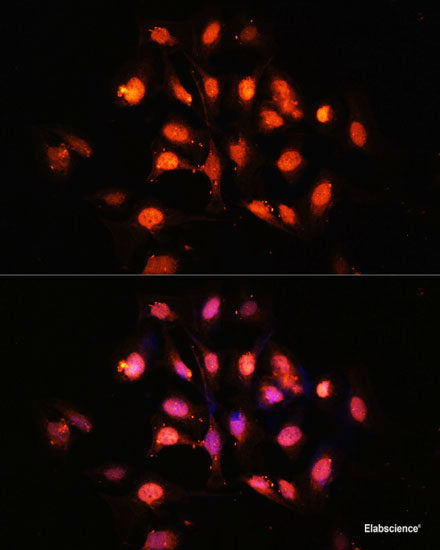 Western blot analysis of extracts of MCF7 cell line using Phospho-CHEK1(S317) Polyclonal Antibody.