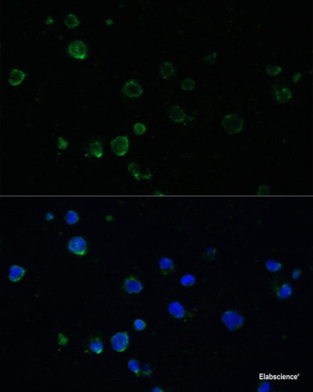 Western blot analysis of extracts of K-562 and MCF-7 cells using Phospho-MEF2C(S396) Polyclonal Antibody at dilution of 1:1000. K562 cells were treated by 10% FBS for 30 minutes after serum-starvation overnight. MCF7 cells were treated by EGF (100ng/ml) for 30 minutes after serum-starvation overnight.