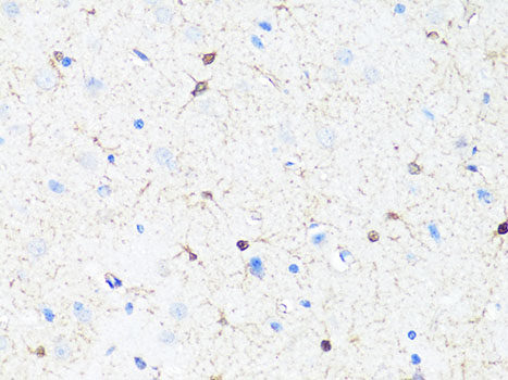 Immunofluorescence analysis of NIH/3T3 cells using GSK3A Polyclonal Antibody at dilution of 1:100. Blue: DAPI for nuclear staining.