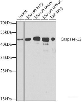 Western blot analysis of extracts of various cell lines using MYD88 Polyclonal Antibody at dilution of 1:1000.