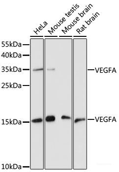 Immunohistochemistry of paraffin-embedded Mouse lung using PI3 Kinase p110 beta Polyclonal Antibody at dilution of 1:100 (40x lens).