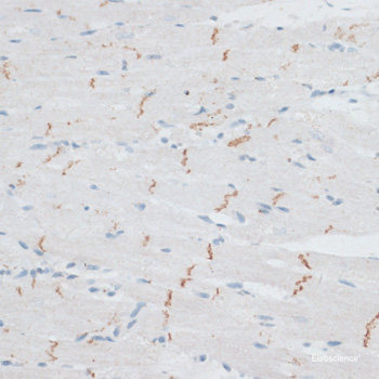 Western blot analysis of extracts from normal (control) and YAP1 knockout (KO) HeLa cells using YAP1 Polyclonal Antibody at dilution of 1:1000.