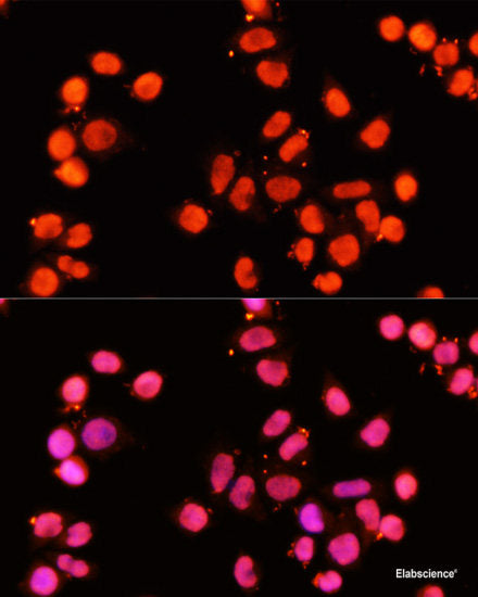 Western blot analysis of extracts of various cell lines using RBM22 Polyclonal Antibody at dilution of 1:1000.