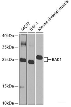 Western blot analysis of extracts of various cell lines using RGS13 Polyclonal Antibody at dilution of 1:1000.