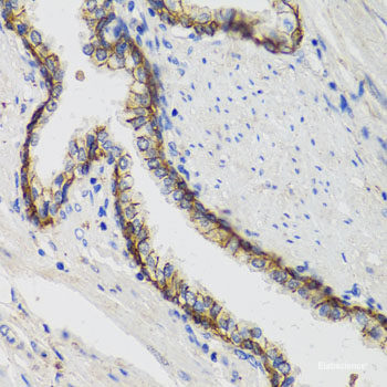 Immunohistochemistry of paraffin-embedded Mouse stomach using MSMB Polyclonal Antibody at dilution of 1:100 (40x lens).