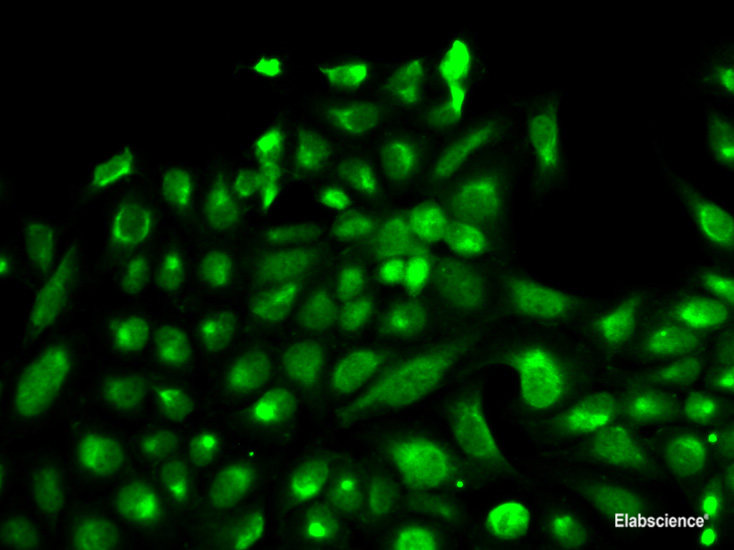 Western blot analysis of extracts of Mouse brain using ATP2B4 Polyclonal Antibody at dilution of 1:1000.