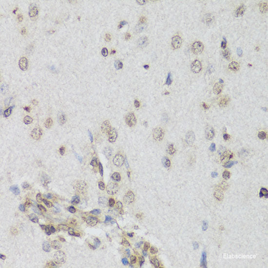 Western blot analysis of extracts of various cell lines using INPPL1 Polyclonal Antibody at dilution of 1:1000.