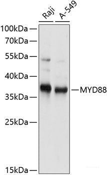 Immunofluorescence analysis of C6 cells using GPER1 Polyclonal Antibody at dilution of 1:100. Blue: DAPI for nuclear staining.