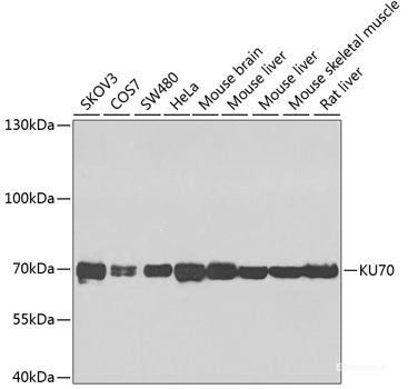 Immunohistochemistry of paraffin-embedded Human breast cancer using EIF3B Polyclonal Antibody at dilution of 1:100 (40x lens).