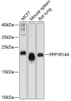 Immunofluorescence analysis of U-2 OS cells using SEC14L2 Polyclonal Antibody at dilution of 1:100 (40x lens). Blue: DAPI for nuclear staining.