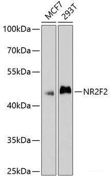 Immunofluorescence analysis of Human placenta cells using MYH11 Polyclonal Antibody at dilution of 1:100. Blue: DAPI for nuclear staining.