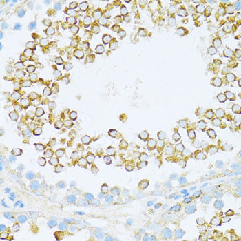 Immunofluorescence analysis of HeLa cells using HDAC6 Polyclonal Antibody at dilution of 1:100 (40x lens). Blue: DAPI for nuclear staining.