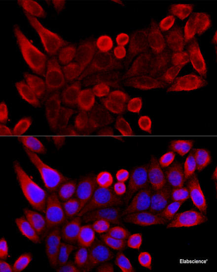 Immunohistochemistry of paraffin-embedded Rat liver using YAP1 Polyclonal Antibody at dilution of 1:100 (40x lens).