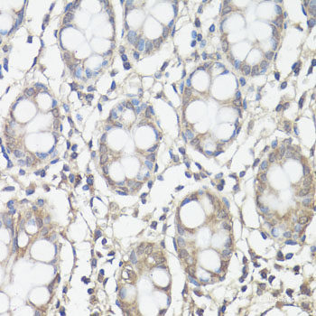 Immunohistochemistry of paraffin-embedded Rat testis using DDX3Y Polyclonal Antibody at dilution of 1:100 (40x lens).