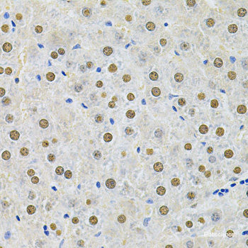 Immunohistochemistry of paraffin-embedded Rat liver using CDC25A Polyclonal Antibody at dilution of 1:100 (40x lens).