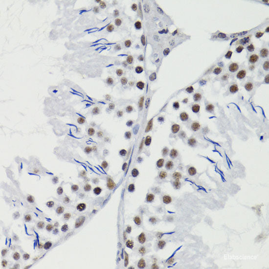 Immunofluorescence analysis of HeLa cells using CAT Polyclonal Antibody at dilution of 1:100. Blue: DAPI for nuclear staining.
