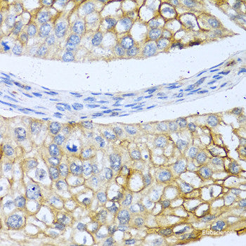 Immunofluorescence analysis of C6 cells using TLR3 Polyclonal Antibody at dilution of 1:100. Blue: DAPI for nuclear staining.