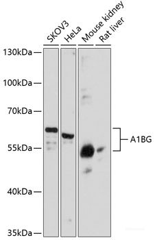 Immunofluorescence analysis of HeLa cells using RASSF1 Polyclonal Antibody