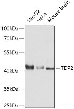 Western blot analysis of extracts of Mouse lung using OLR1 Polyclonal Antibody at dilution of 1:1000.