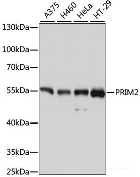 Immunohistochemistry of paraffin-embedded Human prostate using DEFB121 Polyclonal Antibody at dilution of 1:100 (40x lens).