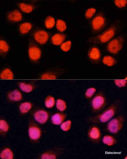 Immunohistochemistry of paraffin-embedded Rat heart using CA3 Polyclonal Antibody at dilution of 1:100 (40x lens).