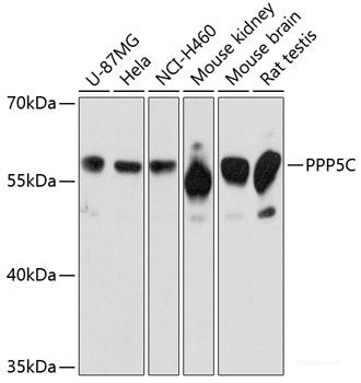 Western blot analysis of extracts of Rat liver using ARRDC3 Polyclonal Antibody at dilution of 1:3000.