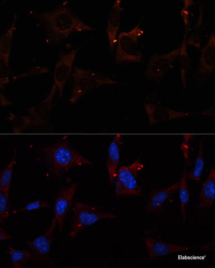 Immunohistochemistry of paraffin-embedded Mouse kidney using SRPX Polyclonal Antibody at dilution of 1:100 (40x lens).